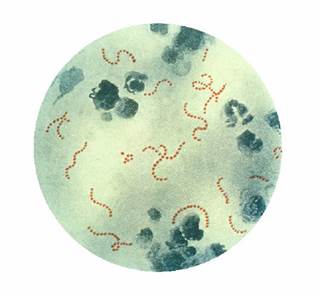 Risk of any mental disorder was increased for individuals with a positive streptococcal test compared to those without a streptococcal test. <i>Photo Credit: CDC.</i> Risk of any mental disorder was increased for individuals with a positive streptococcal test compared to those without a streptococcal test. <i>Photo Credit: CDC.</i>