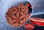 End-of-Treatment HBsAg Levels May Predict HBV Relapse in Chronic Hepatitis B End-of-Treatment HBsAg Levels May Predict HBV Relapse in Chronic Hepatitis B