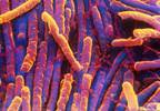C difficile Treatment and Prevention: Novel Antibiotics and Immunologic Therapies C difficile Treatment and Prevention: Novel Antibiotics and Immunologic Therapies