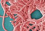 CDC: High Rate of Legionnaires' Disease in Healthcare Facilities CDC: High Rate of Legionnaires' Disease in Healthcare Facilities