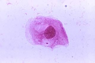 Although there are no clear preferences for one vaccine over the other, they are not interchangeable. <i>Photo Credit: CDC/James Volk.</i> Although there are no clear preferences for one vaccine over the other, they are not interchangeable. <i>Photo Credit: CDC/James Volk.</i>