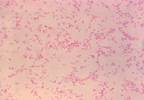 Legionella Detected in NYC Police Station, Las Vegas Resort Legionella Detected in NYC Police Station, Las Vegas Resort