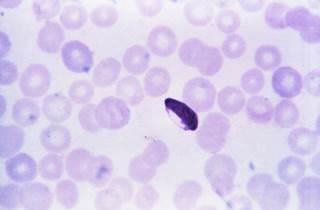 The acquisition of maternal microchimerism may result in increased malaria infection but protection from malaria disease. <i>Photo Credit: CDC/Steven Glenn, Laboratory & Consultation Division.</i> The acquisition of maternal microchimerism may result in increased malaria infection but protection from malaria disease. <i>Photo Credit: CDC/Steven Glenn, Laboratory & Consultation Division.</i>