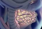 Infant Gut Microbiome Altered by Maternal Antibiotic Use Infant Gut Microbiome Altered by Maternal Antibiotic Use