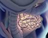 Examining the Link Between Migraine and Gastrointestinal Disorders Examining the Link Between Migraine and Gastrointestinal Disorders