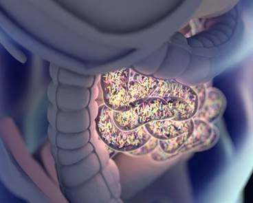 Metachronous gastric cancer risk reduced with H pylori treatment Metachronous gastric cancer risk reduced with H pylori treatment