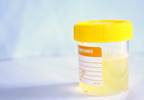 Routine Office Urine Culture Before Prostate Biopsy Is Unnecessary Routine Office Urine Culture Before Prostate Biopsy Is Unnecessary