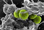 Decrease Rate of S aureus Resistance Seen With Certain Antibiotics Decrease Rate of S aureus Resistance Seen With Certain Antibiotics