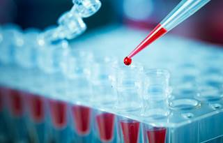 Researchers found that there were no false positives among the plasma or whole blood specimens. Researchers found that there were no false positives among the plasma or whole blood specimens.