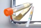 Antibiotics May Not Be Beneficial in Older Adults With UTI Antibiotics May Not Be Beneficial in Older Adults With UTI