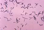 Gut Microbiota Associated With Parkinson's Disease Progression Gut Microbiota Associated With Parkinson's Disease Progression