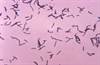 Gut Microbiota Associated With Parkinson's Disease Progression Gut Microbiota Associated With Parkinson's Disease Progression