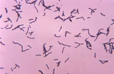 Gut Microbiota Associated With Parkinson's Disease Progression Gut Microbiota Associated With Parkinson's Disease Progression