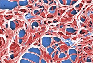 Cases of septic shock, osteomyelitis, Clostridium difficile colitis, and paraspinal abscess have been documented. <i>Photo Credit: Janice Haney Carr.</i> Cases of septic shock, osteomyelitis, Clostridium difficile colitis, and paraspinal abscess have been documented. <i>Photo Credit: Janice Haney Carr.</i>