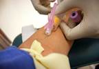 Advances in Point-of-Care Testing and Tips for Clinicians Advances in Point-of-Care Testing and Tips for Clinicians