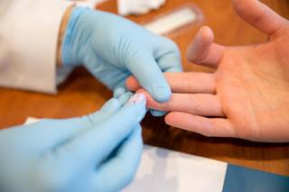 The major advance of Xpert HCV Viral Load point-of-care assay is the ability to detect active HCV infection. The major advance of Xpert HCV Viral Load point-of-care assay is the ability to detect active HCV infection.