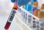 Predictors of HIV Viral Suppression and Durable Suppression in Heterosexuals Predictors of HIV Viral Suppression and Durable Suppression in Heterosexuals