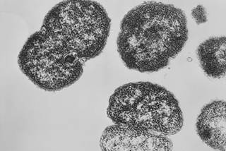 A 31% vaccine effectiveness against gonorrhea was seen with MeNZB. <i>Photo Credit: CDC/ Joe Miller.</i> A 31% vaccine effectiveness against gonorrhea was seen with MeNZB. <i>Photo Credit: CDC/ Joe Miller.</i>