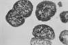 Meningococcal B Vaccine Protective Against Gonorrhea Meningococcal B Vaccine Protective Against Gonorrhea