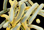 Automated Molecular Assay Detects Drug-Resistant Tuberculosis Automated Molecular Assay Detects Drug-Resistant Tuberculosis