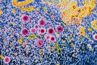 The average transmission rate of maternal primary CMV infection to the fetus is 40%. <i>Photo Credit: CNRI/Science Source.</i> The average transmission rate of maternal primary CMV infection to the fetus is 40%. <i>Photo Credit: CNRI/Science Source.</i>