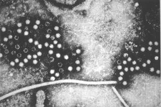 The assay was validated using paired oral fluid and serum samples collected from 141 patients with or without symptoms of acute viral hepatitis. <i>Photo Credit: CDC.</i> The assay was validated using paired oral fluid and serum samples collected from 141 patients with or without symptoms of acute viral hepatitis. <i>Photo Credit: CDC.</i>