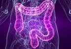 Efficacy of Crofelemer in Chronic HIV-Related Diarrhea Evaluated Efficacy of Crofelemer in Chronic HIV-Related Diarrhea Evaluated