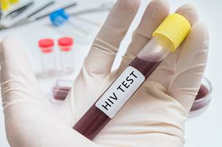The first report of a successful depletion of the HIV reservoirs opens new therapeutic perspectives towards an HIV cure. The first report of a successful depletion of the HIV reservoirs opens new therapeutic perspectives towards an HIV cure.