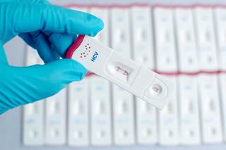 There was an increase in HCV screening from 7.6% for patients with a primary care provider visit in the 6 months before BPA. There was an increase in HCV screening from 7.6% for patients with a primary care provider visit in the 6 months before BPA.
