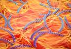 Scalp Nodularity Associated With Secondary Syphilis Scalp Nodularity Associated With Secondary Syphilis
