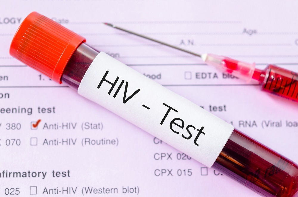 Full Meaning Of Rvs Test For Hiv