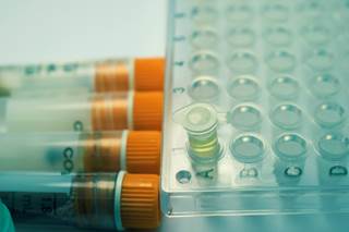 The ArboViroPlex test is named for the 4 arboviruses it targets and the real-time reverse transcription polymerase chain reaction technique it uses. The ArboViroPlex test is named for the 4 arboviruses it targets and the real-time reverse transcription polymerase chain reaction technique it uses.
