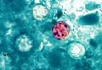 CDC Issues Advisory on the Rise of Cyclosporiasis CDC Issues Advisory on the Rise of Cyclosporiasis