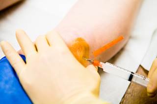 Multiple breaches of recommended infection prevention practices were identified at the New Jersey outpatient practice. Multiple breaches of recommended infection prevention practices were identified at the New Jersey outpatient practice.