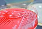 Follow-up Blood Culture in Gram-Negative Bacteremia Should Be Avoided Follow-up Blood Culture in Gram-Negative Bacteremia Should Be Avoided