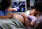 Increase in Proportion of Births at Gestational Age 39 to 40 Weeks Increase in Proportion of Births at Gestational Age 39 to 40 Weeks