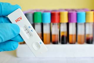 The country of Georgia embarked on the world's first program to eliminate HCV with technical assistance from CDC. The country of Georgia embarked on the world's first program to eliminate HCV with technical assistance from CDC.