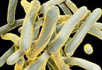 Time to Sputum Culture Conversion Similar in Isoniazid-Resistant and Susceptible TB Time to Sputum Culture Conversion Similar in Isoniazid-Resistant and Susceptible TB