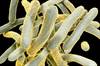 Time to Sputum Culture Conversion Similar in Isoniazid-Resistant and Susceptible TB Time to Sputum Culture Conversion Similar in Isoniazid-Resistant and Susceptible TB
