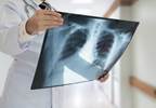 Microbiome Diversity in Respiratory Tract Linked to Airway Inflammation Microbiome Diversity in Respiratory Tract Linked to Airway Inflammation