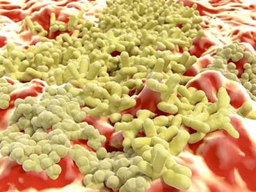 Evidence-Based Care for <i>S aureus</i> Infection Improves Survival Evidence-Based Care for <i>S aureus</i> Infection Improves Survival