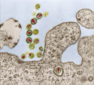 Patients discontinue their antiretroviral therapy due to a host of clinical, social, and structural reasons. Patients discontinue their antiretroviral therapy due to a host of clinical, social, and structural reasons.