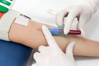 There was an increase in linkage to care among persons with newly diagnosed HCV infection, by approximately 40% in the state of New York. There was an increase in linkage to care among persons with newly diagnosed HCV infection, by approximately 40% in the state of New York.