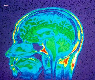 Researchers investigate the relationship between neuroinflammation and MS-related mood symptoms. Researchers investigate the relationship between neuroinflammation and MS-related mood symptoms.