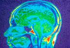 Assessing the Risk Factors of Neurocognitive Decline in HIV+ Individuals Assessing the Risk Factors of Neurocognitive Decline in HIV+ Individuals