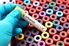 Point-of-Care Testing Methods Compared for Influenza Detection Point-of-Care Testing Methods Compared for Influenza Detection