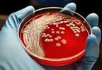 Environmental Screening Effective Proxy for Evaluating MRSA and VRE Rate in Nursing Facilities Environmental Screening Effective Proxy for Evaluating MRSA and VRE Rate in Nursing Facilities