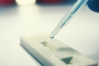 In infected patients, the serum ZIKV NS1 protein concentrations were about 10-fold lower than corresponding DENV NS1 concentrations. In infected patients, the serum ZIKV NS1 protein concentrations were about 10-fold lower than corresponding DENV NS1 concentrations.