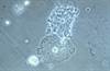 Assessment of Bacterial Vaginosis Screening, Treatment for Prevention of Preterm Delivery Assessment of Bacterial Vaginosis Screening, Treatment for Prevention of Preterm Delivery