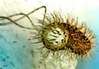 Efficacy of Goshuyuto/Rabeprazole for Refractory H pylori Efficacy of Goshuyuto/Rabeprazole for Refractory H pylori